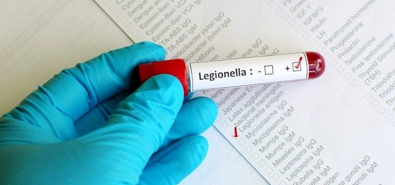 legionella-2.jpg